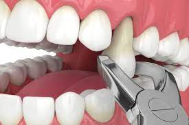 images (4)